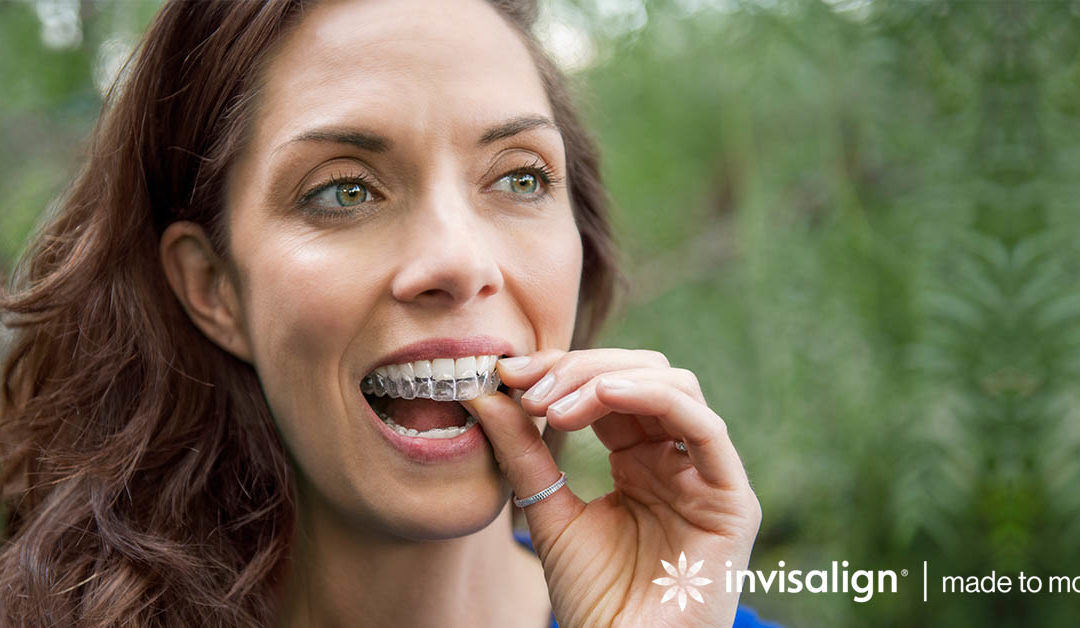 Invisalign Open Day!