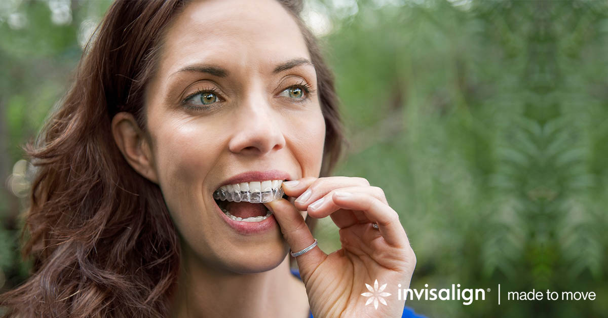 gloucester invisalign open day