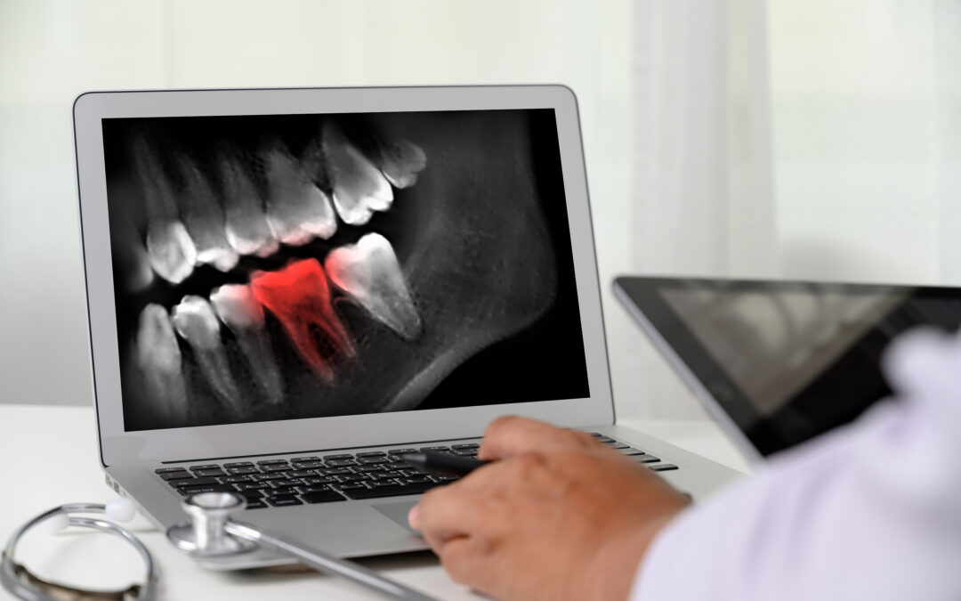 Smarter Dentistry in Gloucester: How AI Is Helping Us Spot Hidden Tooth Decay Earlier