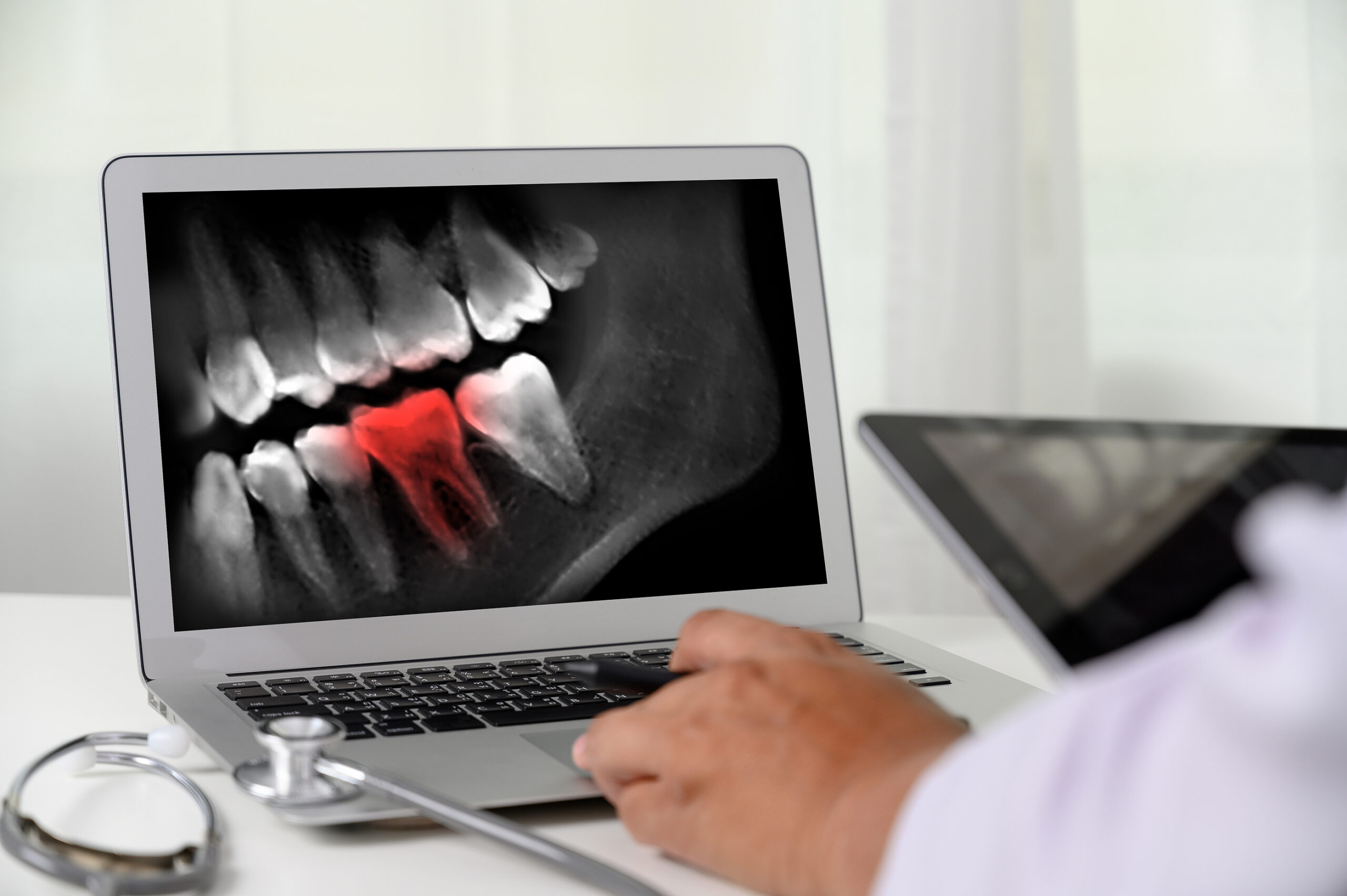 Bigstock Dentist Dental Tool To Teeth X 301705489 Scaled